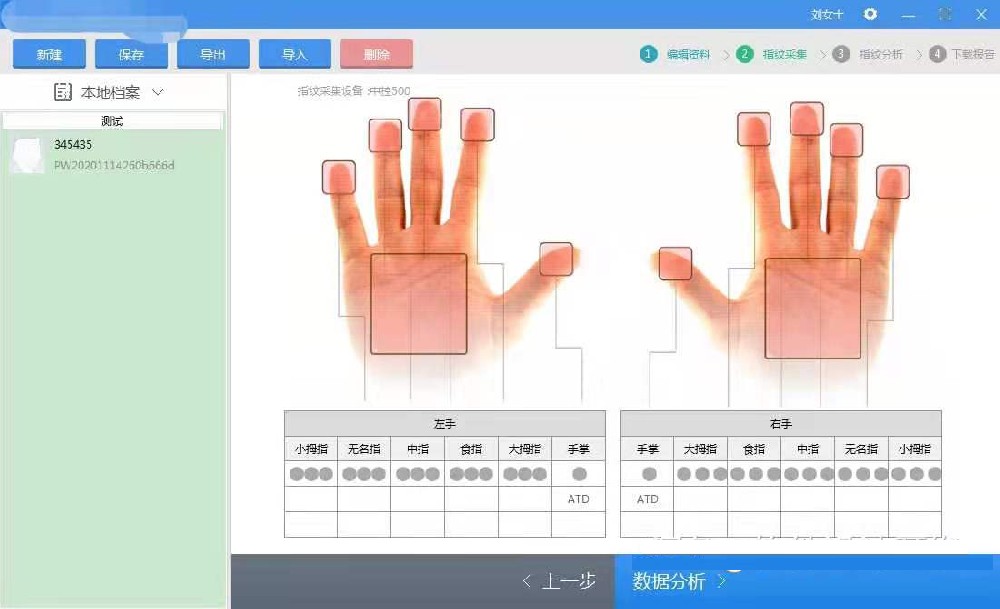 皮紋測試系統,指紋,掌紋采集,報告分(fēn)析輸出,打印報告,模版等